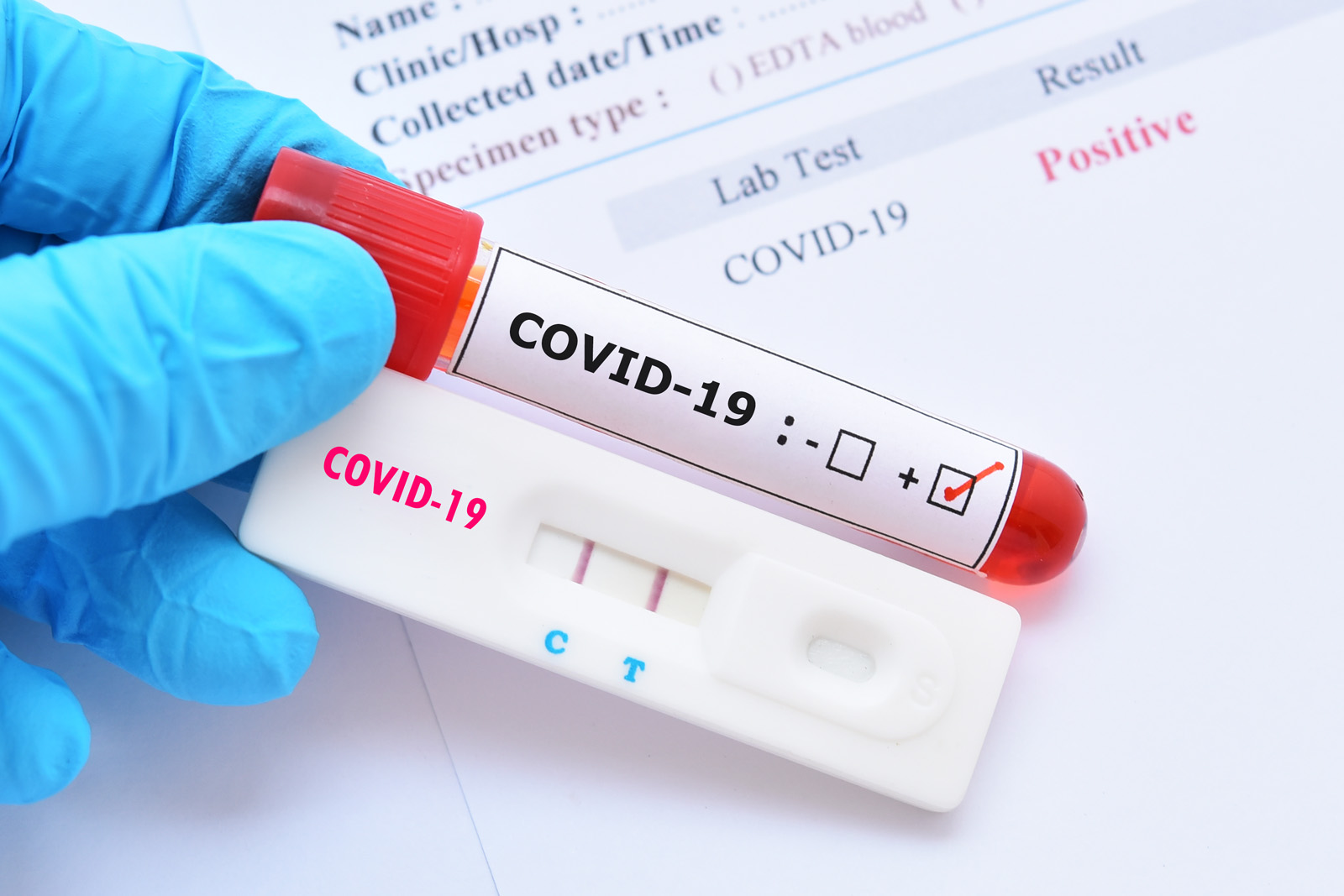 COVID-19 : la HAS positionne les tests antigéniques dans trois situations