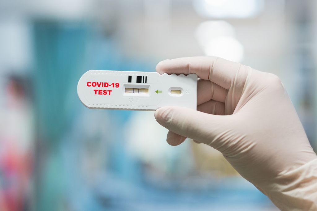 Utilisation des tests antigéniques dans les établissements de santé
